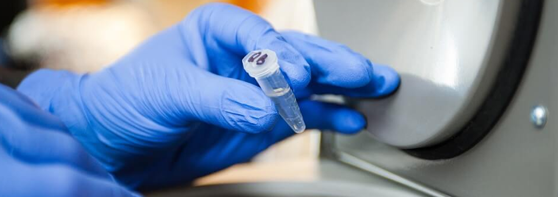 Immunofluorescence Test